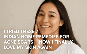 Indian Home Remedies for Acne Scars