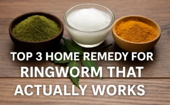 Home Remedy for Ringworm